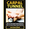 Carpal Tunnel: How To Treat Carpal Tunnel Syndrome: How To Prevent Carpal Tunnel Syndrome