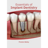 Essentials of Implant Dentistry
