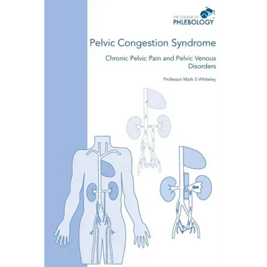 Pelvic Congestion Syndrome - Chronic Pelvic Pain and Pelvic Venous Disorders