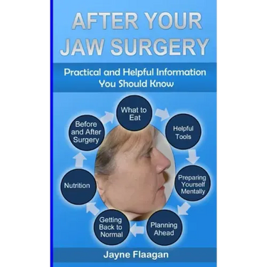 After Your Jaw Surgery: Practical and Helpful Information You Should Know