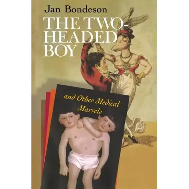 The Two-Headed Boy, and Other Medical Marvels