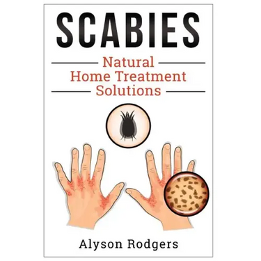 Scabies Natural Home Treatment Solution