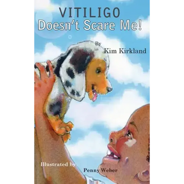 Vitiligo Doesn't Scare Me