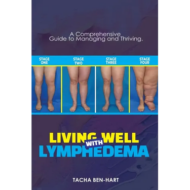 Living Well with Lymphedema: A Comprehensive Guide to Managing and Thriving