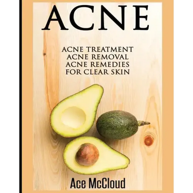 Acne: Acne Treatment: Acne Removal: Acne Remedies For Clear Skin