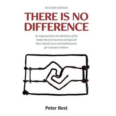 There Is No Difference: An Argument for the Abolition of the Indian Reserve System and Special Race-based Laws and Entitlements for Canada's Indians