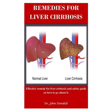 Remedies For Liver Cirrhosis: Effective remedies for liver cirrhosis and safety guide on how to go about it