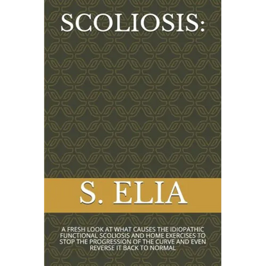 Scoliosis: A Fresh Look at What Causes the Idiopathic Functional Scoliosis and Home Exercises to Stop the Progression of the Curv
