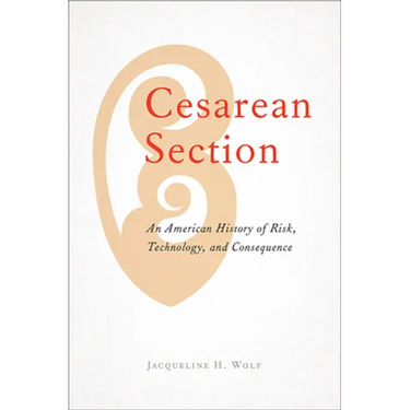 Cesarean Section: An American History of Risk, Technology, and Consequence
