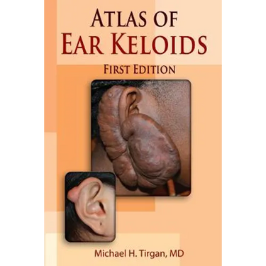 Atlas of Ear Keloids