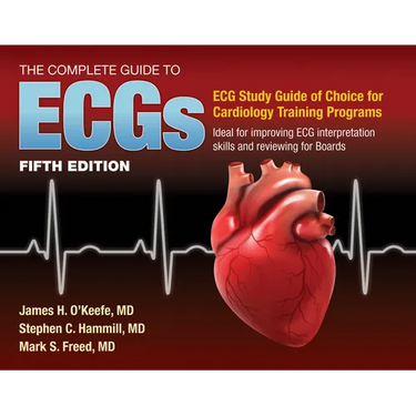 The Complete Guide to Ecgs: A Comprehensive Study Guide to Improve ECG Interpretation Skills: A Comprehensive Study Guide to Improve ECG Interpretatio