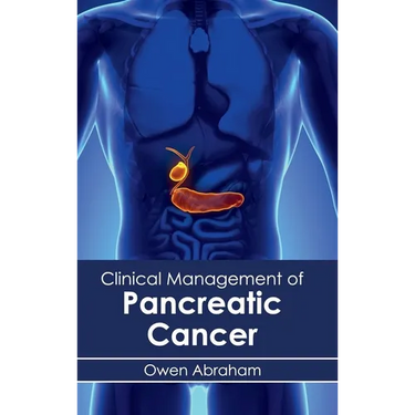 Clinical Management of Pancreatic Cancer