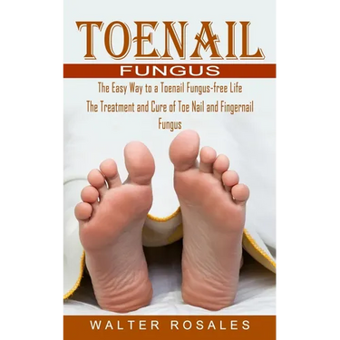 Toenail Fungus: The Easy Way to a Toenail Fungus-free Life (The Treatment and Cure of Toe Nail and Fingernail Fungus)