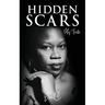 Hidden Scars: My Truth