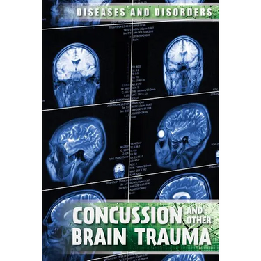 Concussions and Other Brain Trauma