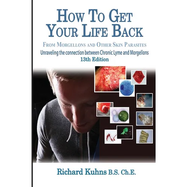 How to Get Your Life Back From Morgellons and Other Skin Parasites Limited Edit