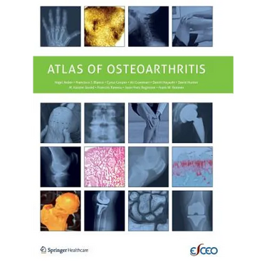 Atlas of Osteoarthritis