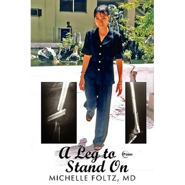 A Leg to Stand On