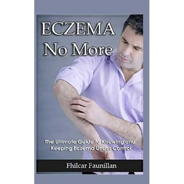 Eczema Cure: Eczema No More - The Ultimate Guide to Knowing and Keeping Eczema Under Control