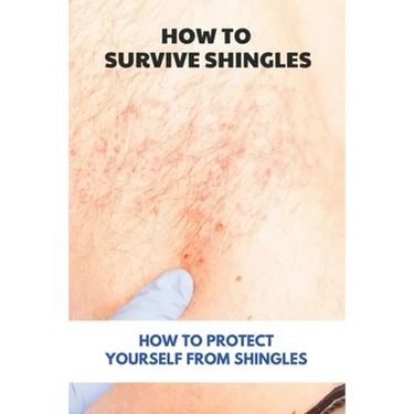 How To Survive Shingles: How To Protect Yourself From Shingles: How To Speed Up Shingles Recovery