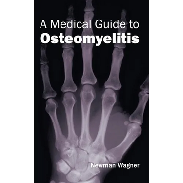 Medical Guide to Osteomyelitis