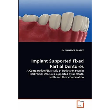 Implant Supported Fixed Partial Dentures