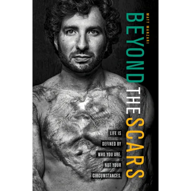 Beyond the Scars: Life Is Defined by Who You Are, Not Your Circumstances