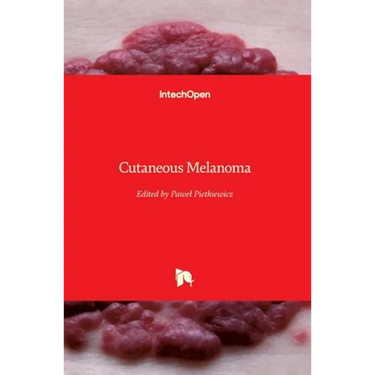 Cutaneous Melanoma