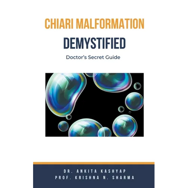 Chiari Malformation Demystified: Doctor's Secret Guide