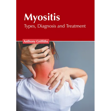 Myositis: Types, Diagnosis and Treatment