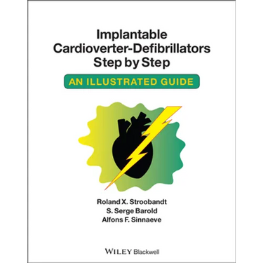 Implantable Cardioverter - Defibrillators Step by Step: An Illustrated Guide