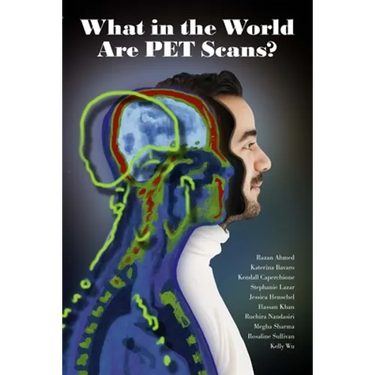 What in the World are PET Scans?