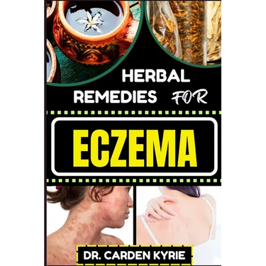 Herbal Remedies for Eczema: Unlocking Nature's Healing Power With Herbs For Flourishing Skin, Holistic Wellness, Lasting Relief And Healthy Lifestyle