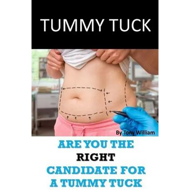 Tummy Tuck: Are You The Right Candidate For A Tummy Tuck