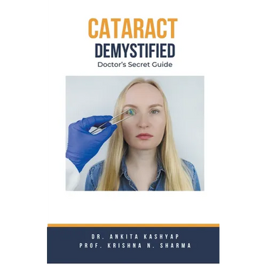 Cataract Demystified: Doctor's Secret Guide