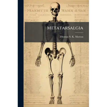 Metatarsalgia