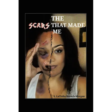 The Scars That Made Me