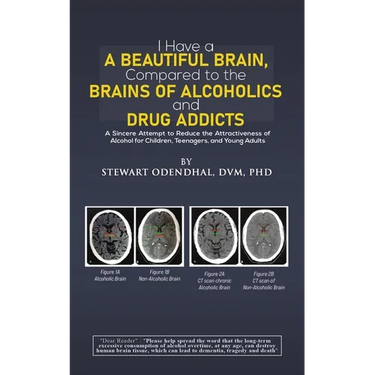 I Have a Beautiful Brain, Compared to the Brains of Alcoholics and Drug Addicts