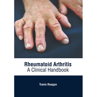 Rheumatoid Arthritis: A Clinical Handbook