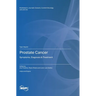 Prostate Cancer: Symptoms, Diagnosis & Treatment