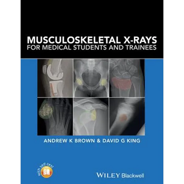 Musculoskeletal X-Rays for Medical Students and Trainees
