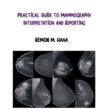 Practical Guide to Mammography Interpretation and Reporting