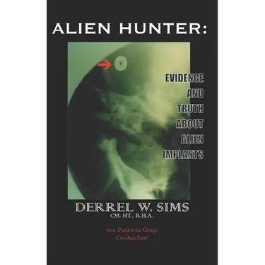 Alien Implants: Evidence & Truth about Alien Implants