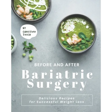 Before and After Bariatric Surgery: Delicious Recipes for Successful Weight Loss