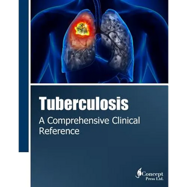 Tuberculosis: A Comprehensive Clinical Reference