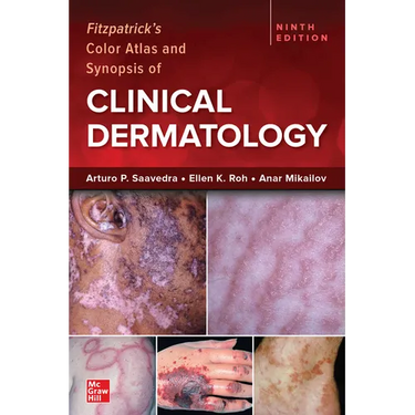 Fitzpatrick's Color Atlas and Synopsis of Clinical Dermatology, Ninth Edition