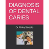 Diagnosis of Dental Caries