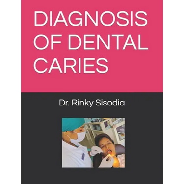 Diagnosis of Dental Caries