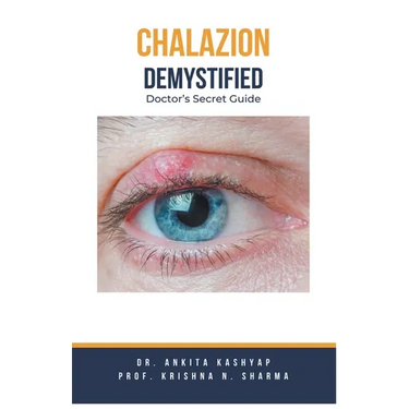 Chalazion Demystified: Doctor's Secret Guide