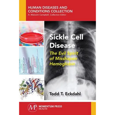Sickle Cell Disease: The Evil Spirit of Misshapen Hemoglobin